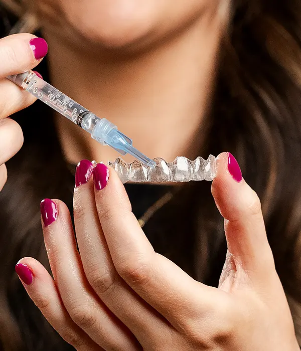 Close-up of a person applying whitening gel from a syringe into a clear custom dental tray, suggesting a professional teeth whitening process.