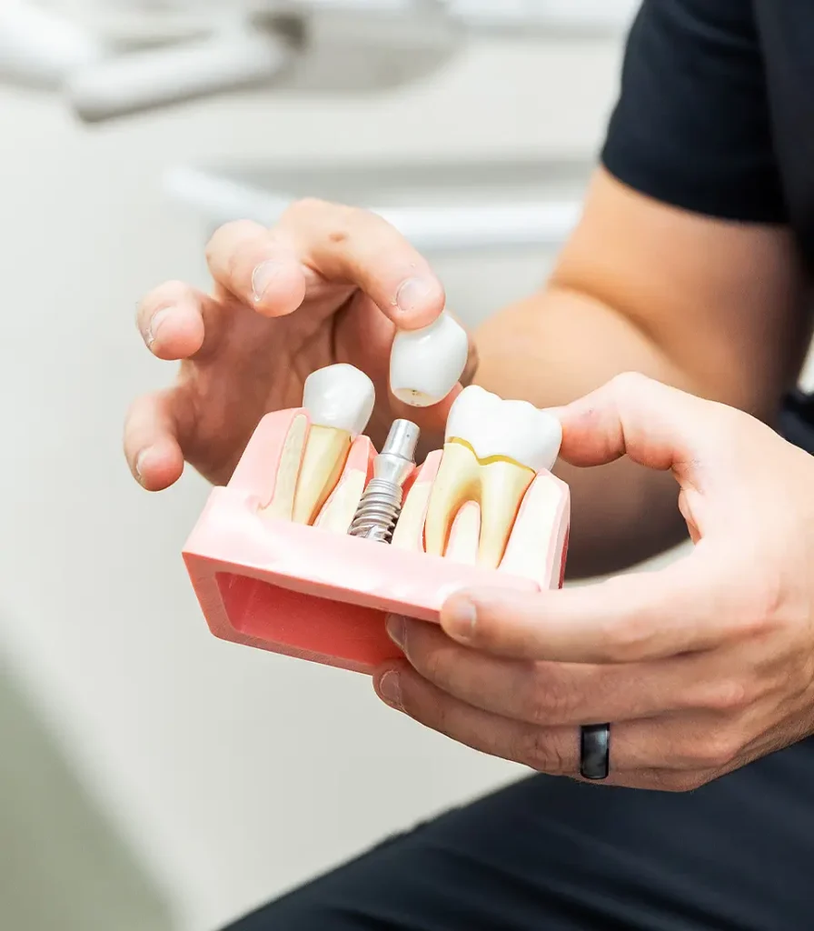 Dentist holding a model of a dental implant with crown placement to explain restorative procedure.