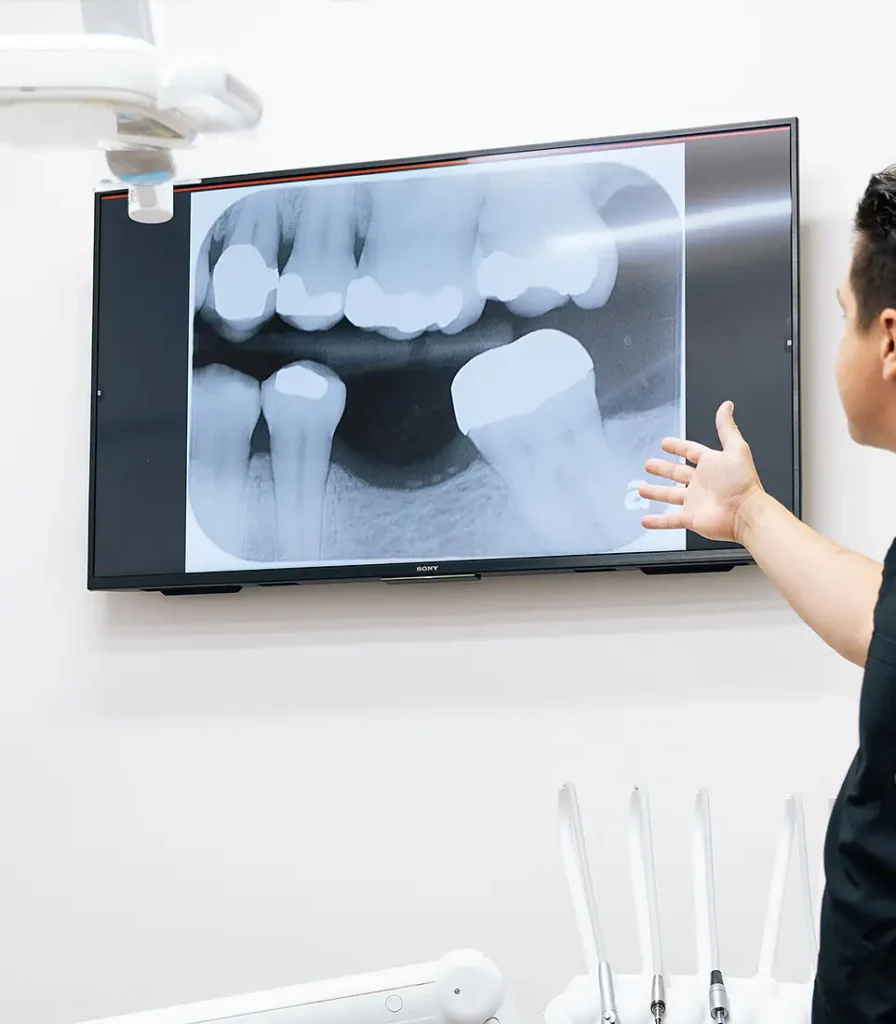 Dentist pointing at dental X-ray displayed on a wall-mounted monitor during patient consultation.