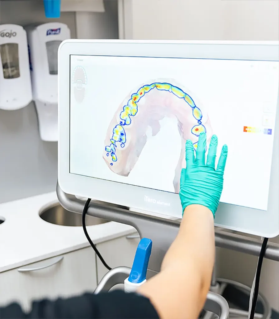 Dental professional using an iTero intraoral scanner, with a 3D digital scan of teeth displayed on the screen.